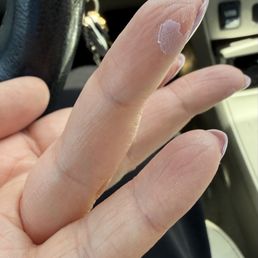 Gel manicure (bad) Gel manicure (bad)