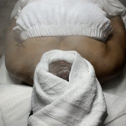 More Than Pretty Aesthetics Services - Hot towel and steam