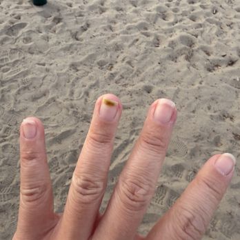 La Belle Nail Bar - Ig: socalhkfoodies when infection was almost gone, took 2+ months... - Nail Salons Near Me - Torrance, California