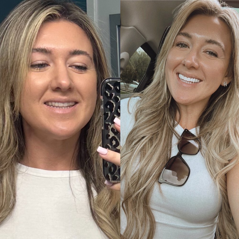 Ryan Savage, DDS - Before and After - Cosmetic Dentists Near Me - Orange, California Ryan Savage, DDS - Before and After - Cosmetic Dentists Near Me - Orange, California