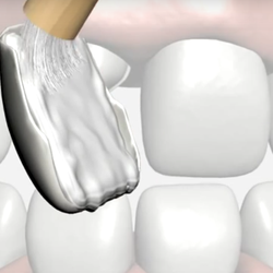 Mark W Johnson, DDS