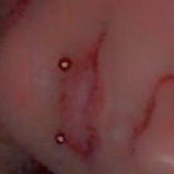 Craig the Piercer - snake bites - Piercing Near Me - Orange, California