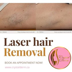 Crystal Derm