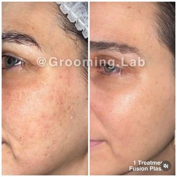 Via Venus Aesthetics - Aestheticians Near Me - Tracy, California Via Venus Aesthetics - Aestheticians Near Me - Tracy, California