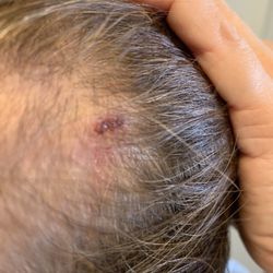 Total Real Estate of Nevada - Head Injury from laundry doors