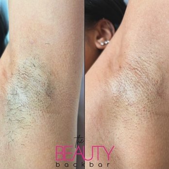 The Beauty Backbar - Ig post - Waxing Near Me - Las Vegas, Nevada The Beauty Backbar - Ig post - Waxing Near Me - Las Vegas, Nevada