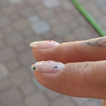 Neat Nails - Lumpy and misshapen nails. - Nail Salons Near Me - Tucson, Arizona