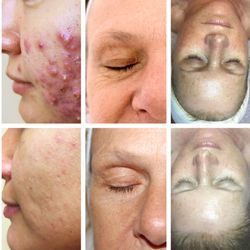 Holistic Skin Care Tampa - Creating positive changes in the skin, solutions = transformation