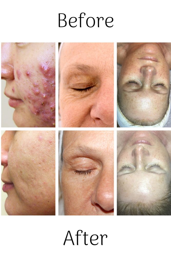 Holistic Skin Care Tampa Logo