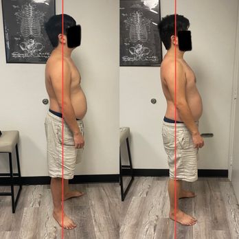 Orange County Myotherapy - Massage Therapy Near Me - Tustin, California Orange County Myotherapy - Massage Therapy Near Me - Tustin, California