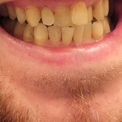 Grayslake Dentistry