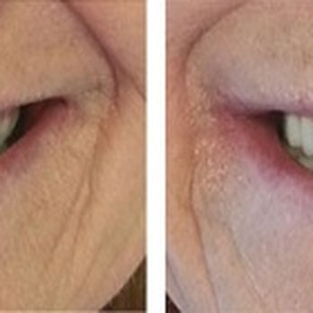 Prairie Dental Group - Cosmetic Surgeons Near Me - Springfield, Illinois Prairie Dental Group - Cosmetic Surgeons Near Me - Springfield, Illinois