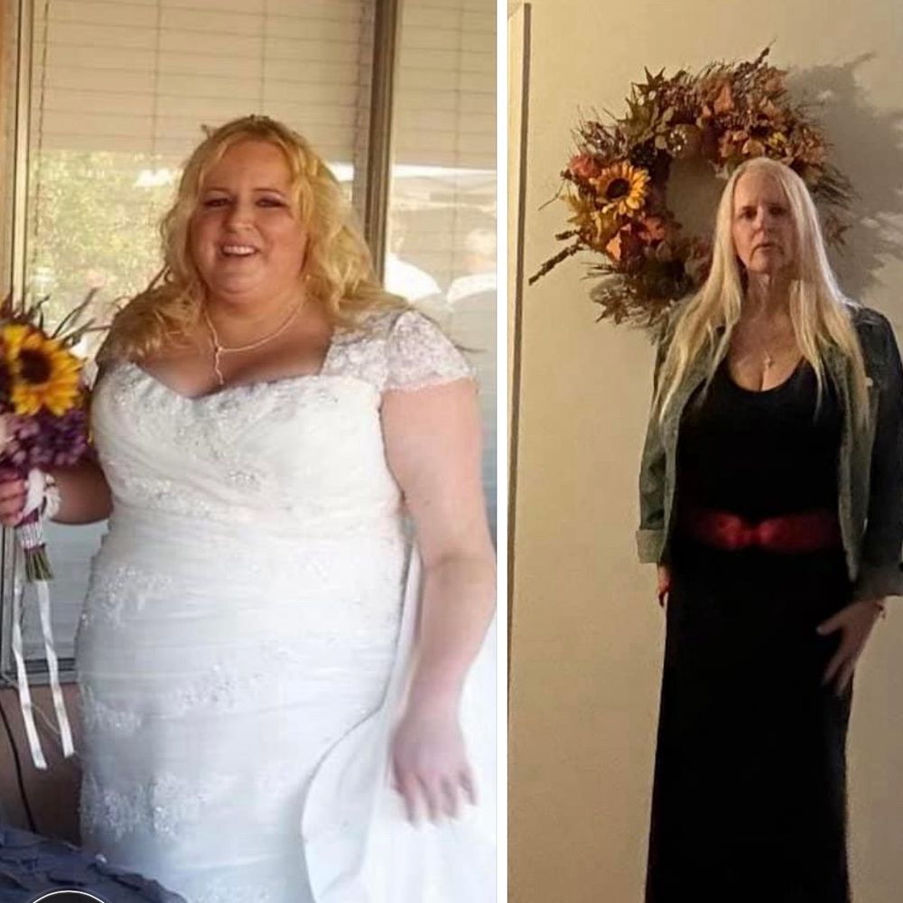 ReEnvision Aesthetics and MedSpa - Over 120 pounds lost thanks to ReEnvision MedSpa and Doctor Lesley Prince!! No surgery!! - Medical Spas Near Me - Simi Valley, California ReEnvision Aesthetics and MedSpa - Over 120 pounds lost thanks to ReEnvision MedSpa and Doctor Lesley Prince!! No surgery!! - Medical Spas Near Me - Simi Valley, California