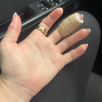 Accelerated Urgent Care - Infected finger wrapped - Urgent Care Near Me - Chino, California Accelerated Urgent Care - Infected finger wrapped - Urgent Care Near Me - Chino, California