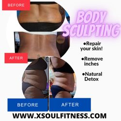 Also inquire about Body Cavitations/ Sculpting...