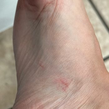 Herbal Nails & Spa - Whittier - Two cuts on my wife's foot after her pedicure here -- the lower one is still raw and red a day later. - Nail Salons Near Me - Whittier, California Herbal Nails & Spa - Whittier - Two cuts on my wife's foot after her pedicure here -- the lower one is still raw and red a day later. - Nail Salons Near Me - Whittier, California