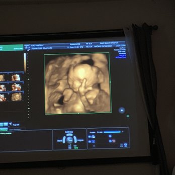 Baby Bump Studios - Diagnostic Imaging Near Me - Ontario, California Baby Bump Studios - Diagnostic Imaging Near Me - Ontario, California
