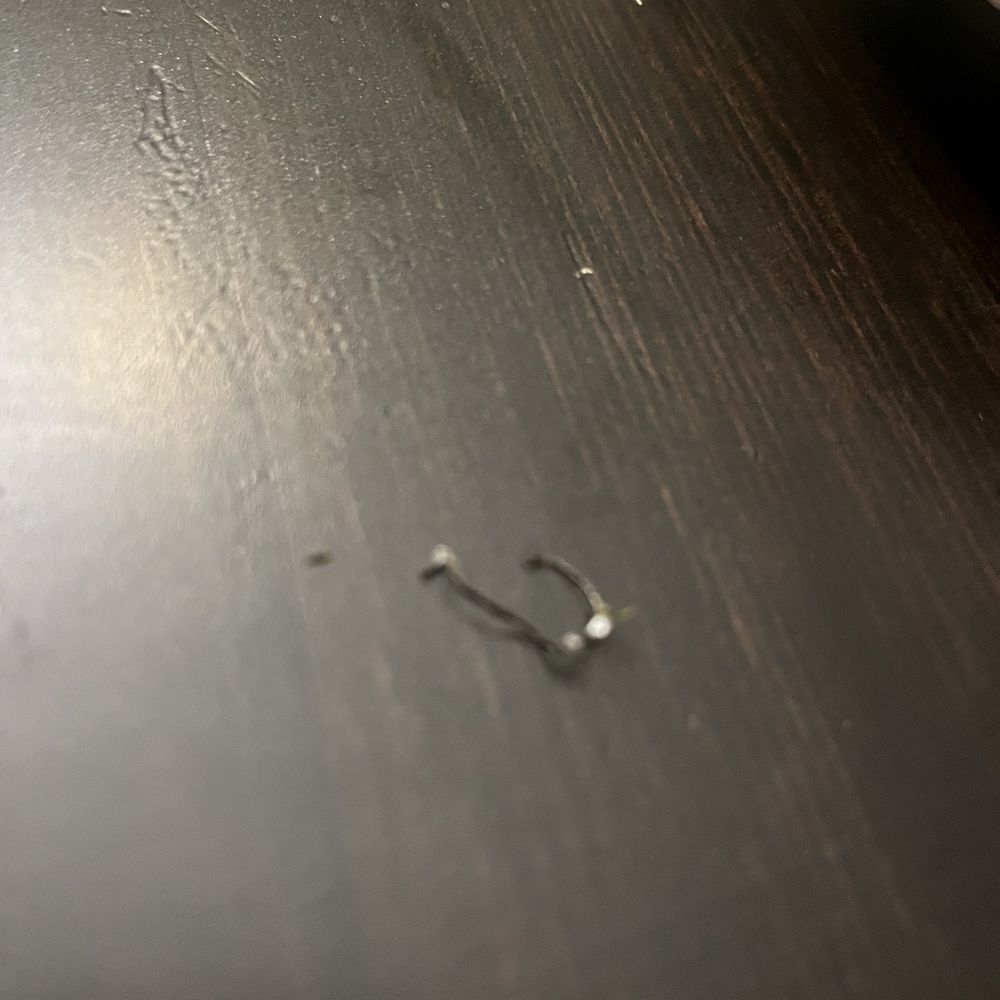 Lazy Acres Market - The piece of metal that came on my food area - Grocery Near Me - Encinitas, California Lazy Acres Market - The piece of metal that came on my food area - Grocery Near Me - Encinitas, California