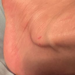Cut on my ankle from the rough service from the nail tech via the'cheese grater' Cut on my ankle from the rough service from the nail tech via the'cheese grater'