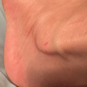 Kailua Nail Care - Cut on my ankle from the rough service from the nail tech via the'cheese grater' - Nail Salons Near Me - Kailua, Hawaii Kailua Nail Care - Cut on my ankle from the rough service from the nail tech via the'cheese grater' - Nail Salons Near Me - Kailua, Hawaii