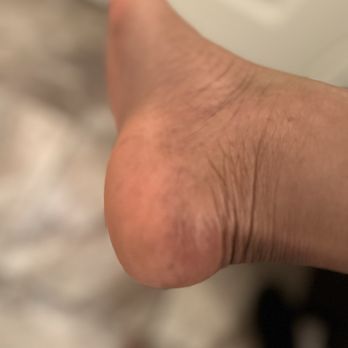 Mona Nail Studio - Right heel looks great - Nail Technicians Near Me - Los Angeles, California
