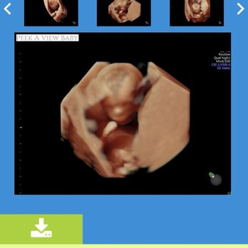 Peek A View Baby - Ultrasound Imaging Centers Near Me - Chesapeake, Virginia Peek A View Baby - Ultrasound Imaging Centers Near Me - Chesapeake, Virginia