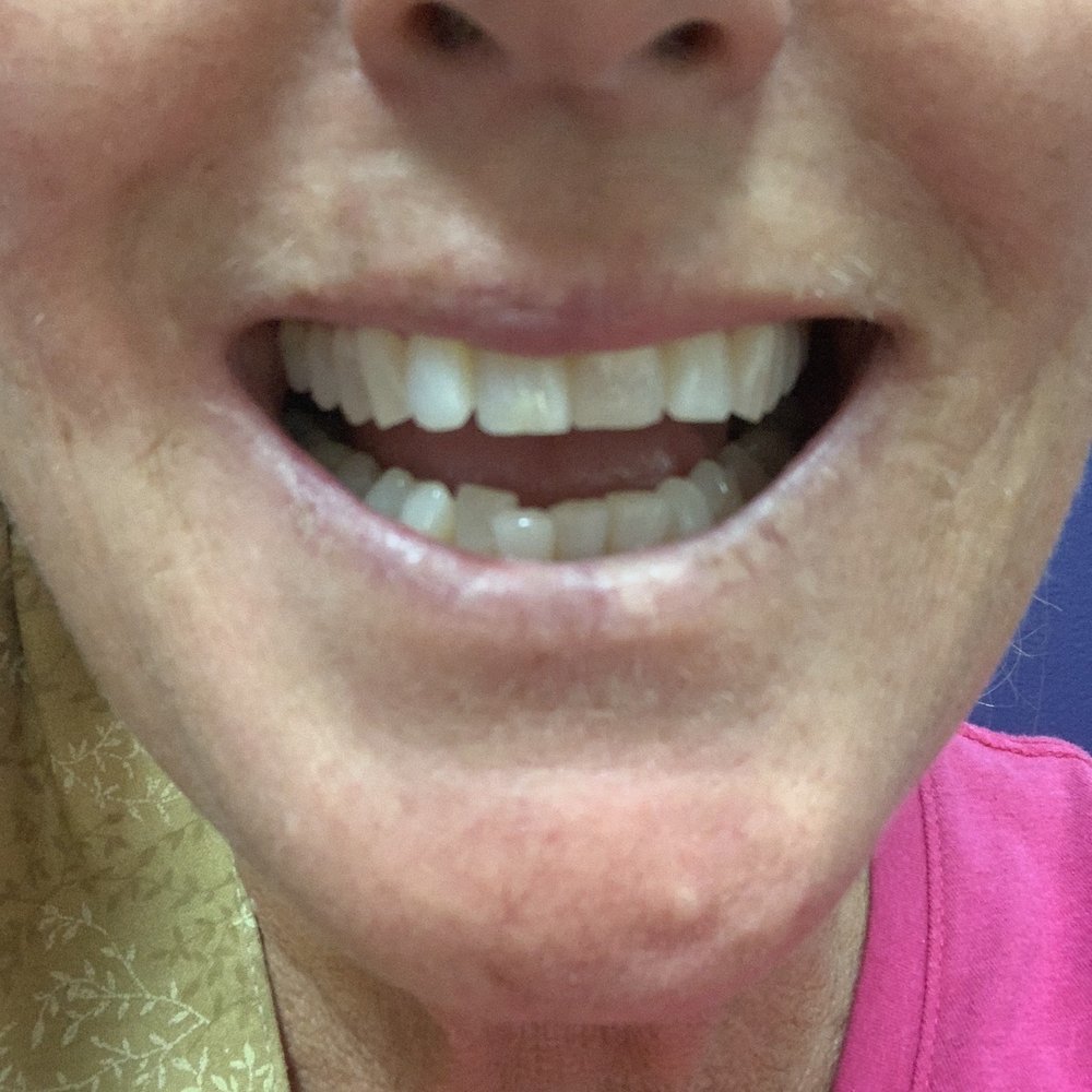 Purvi Shah, DDS - General Dentistry Near Me - Folsom, California