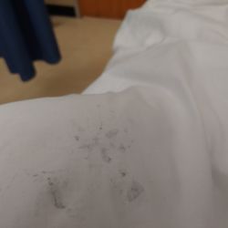 VCU Health - Stained sheets