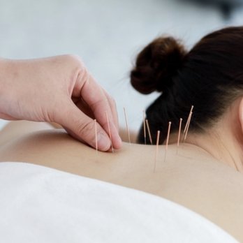 West Gen Acupuncture - Acupuncture Near Me - Syracuse, New York West Gen Acupuncture - Acupuncture Near Me - Syracuse, New York