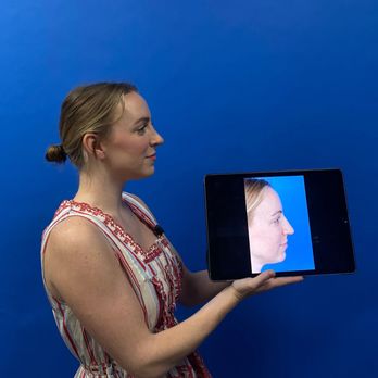 Westlake Plastic Surgery - Rhinoplasty before and after - Cosmetic Surgeons Near Me - Austin, Texas Westlake Plastic Surgery - Rhinoplasty before and after - Cosmetic Surgeons Near Me - Austin, Texas