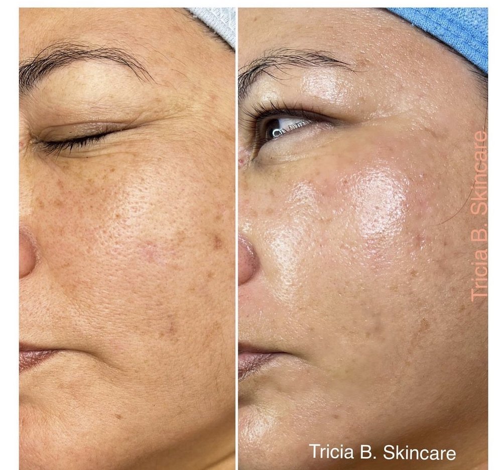 TRICIA B SKINCARE 77 Photos & 59 Reviews 100 S Artsakh Ave, Glendale, California Skin Care