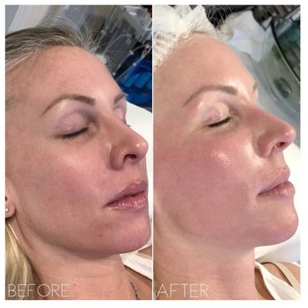 AskCares - BB Glow - Skin Care Near Me - Los Angeles, California