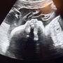 Photo of I Saw You First Imaging