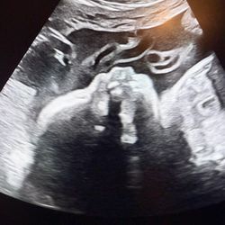 I Saw You First Imaging - 2D ultrasound ,