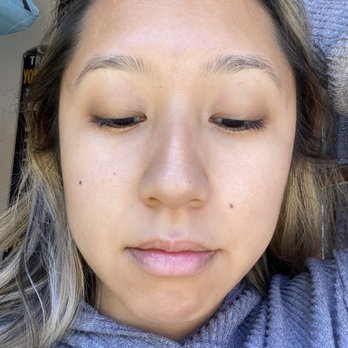 Facile Dermatology + Boutique - 3 weeks later! Skin still glowing and healthy!!! - Skin Care Near Me - Pasadena, California