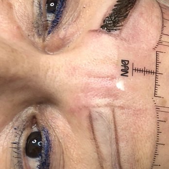 Avanti Skin - In process - Medical Spas Near Me - Miami, Florida
