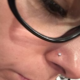 1 week after bump treatment with a new jewelry change 1 week after bump treatment with a new jewelry change
