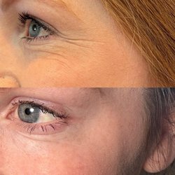 Savvy Rejuvenation & IV Bar