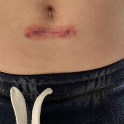 Care Station Medical Group - Injury I was seeking help for.