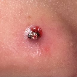 After Priscilla tried taking the piercing out After Priscilla tried taking the piercing out