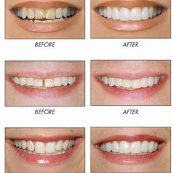 Brite Smile Family Dentistry