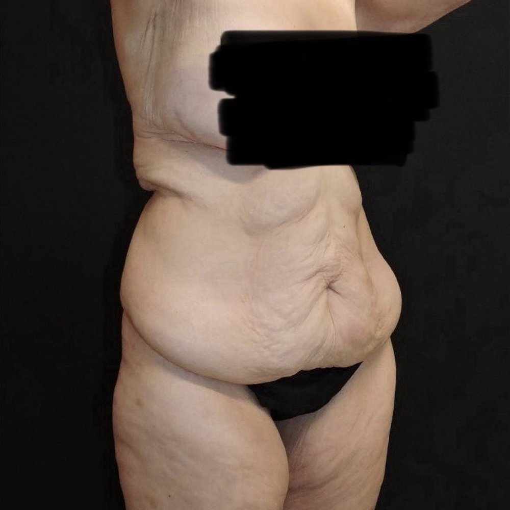 Napa Solano Plastic Surgery - Before - Plastic Surgeons Near Me - Vacaville, California Napa Solano Plastic Surgery - Before - Plastic Surgeons Near Me - Vacaville, California