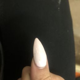 Nail breaking and ton of acrylic she applied on top of the broken nail Nail breaking and ton of acrylic she applied on top of the broken nail