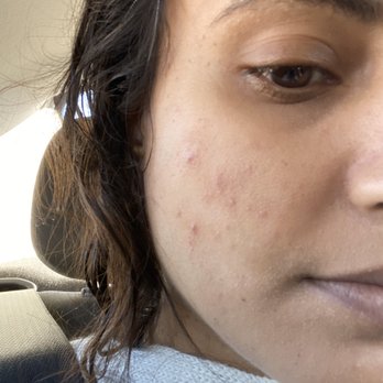 InjectAbility Clinic - Skin Care Near Me - Torrance, California