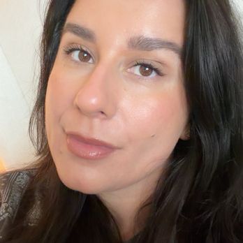 VIO Med Spa - day after hydrafacial with emily - Medical Spas Near Me - Naperville, Illinois