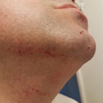 Dope Barbershop - bleeding all over face - Barbers Near Me - Fresno, California
