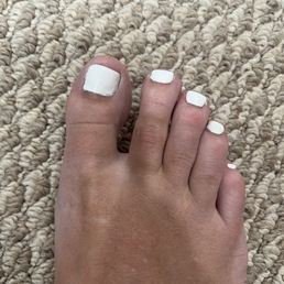 Botched toe nail.