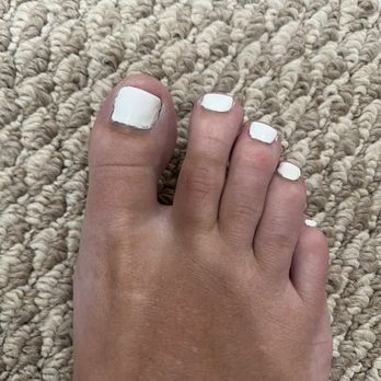 InStyle Salon - Botched toe nail. - Nail Salons Near Me - San Mateo, California