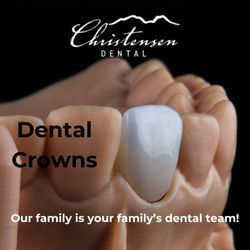 Tyler M Christensen, DDS - Dental crowns are one of the more common dental procedures performed in dental offices across the valley.