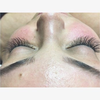 Beauty By Lana - After - Skin Care Near Me - Newark, California Beauty By Lana - After - Skin Care Near Me - Newark, California